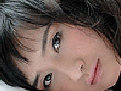 子宫肌瘤鉴别诊断之二